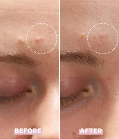 CAIA Cosmetics Oljig/ Kombinerad Hy|Punktbehandling<OH MY CICA SPOT GEL CREAM